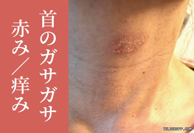 Telegram如何使用表情包？